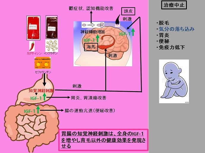 円形脱毛症　病院